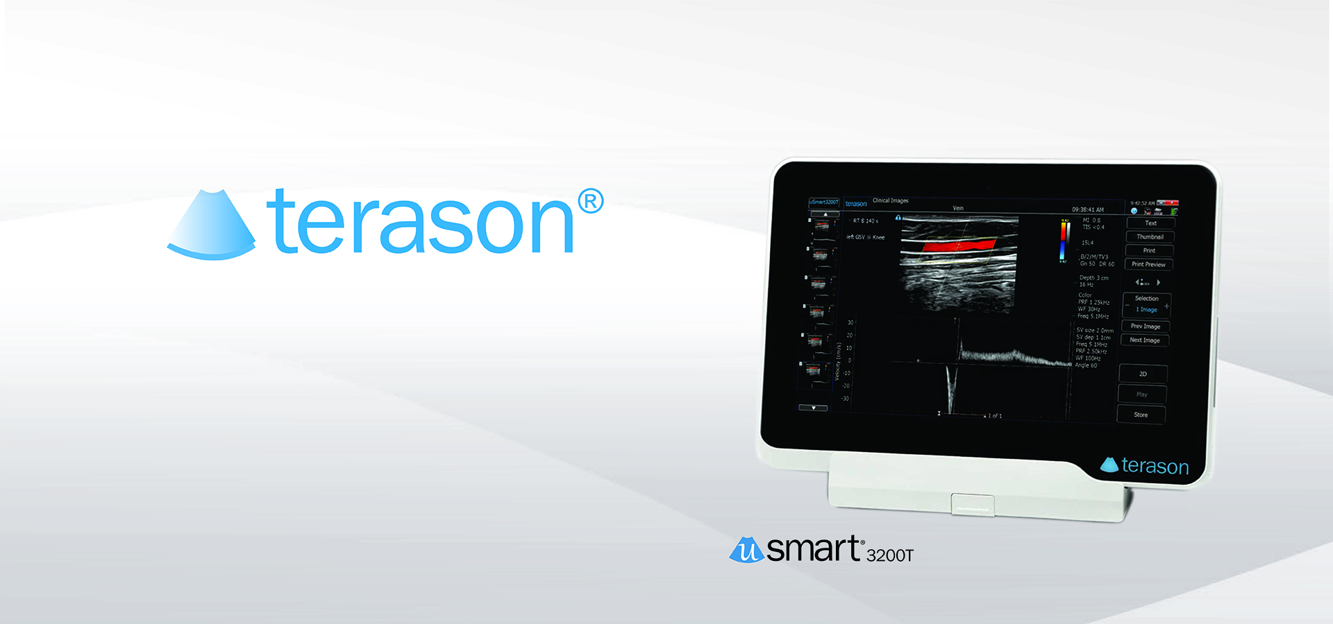 uSmart 3200T