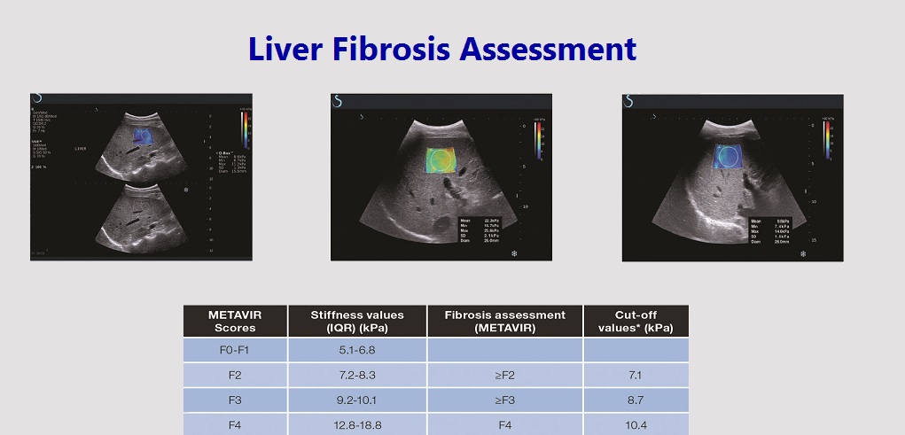 Fibrosis